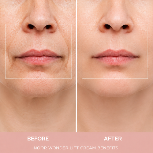 NEXURA WonderLift Cream